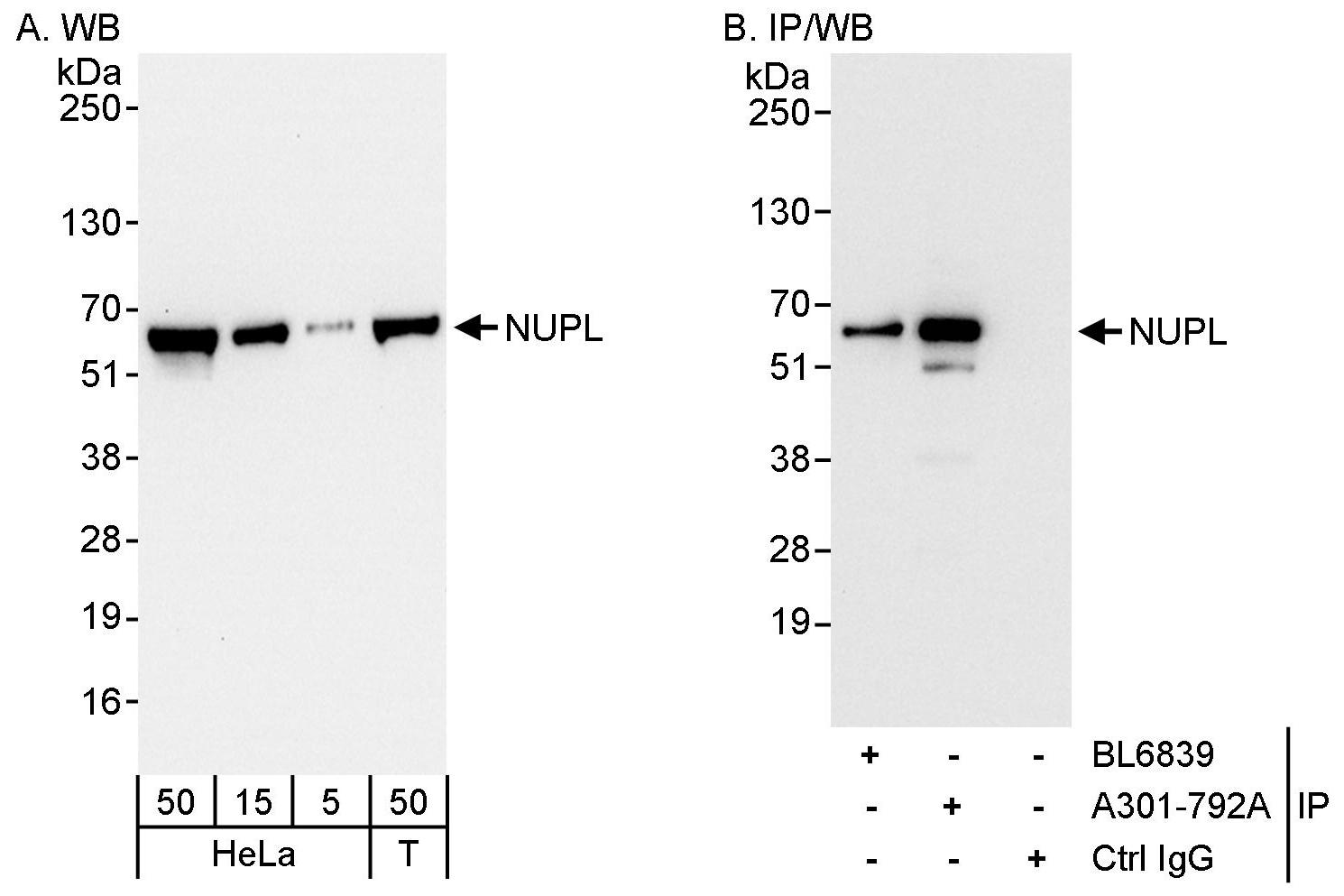 Detection of human NUPL by western blot and immunoprecipitation.