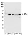 Detection of human and mouse ERp5 by western blot.