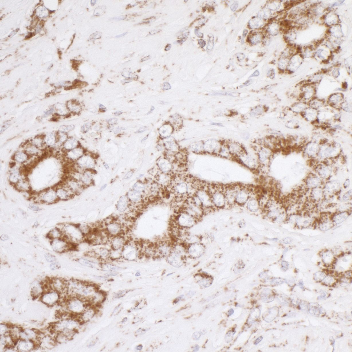 Detection of human ATP5A1 by immunohistochemistry.