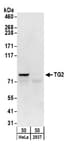 Detection of human TG2 by western blot.