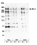 Detection of human MLL1 by western blot.