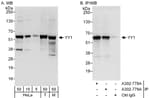 Detection of human and mouse YY1 by western blot (h&amp;m) and immunoprecipitation (h).