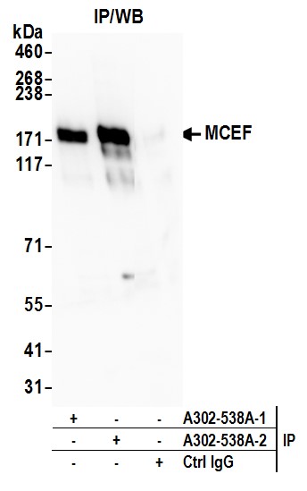 Detection of human MCEF by western blot of immunoprecipitates.