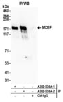 Detection of human MCEF by western blot of immunoprecipitates.