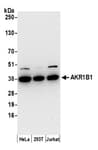 Detection of human AKR1B1 by western blot.