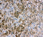 Detection of human L-FABP by immunohistochemistry.