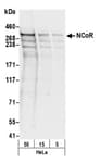 Detection of human NCoR by western blot.