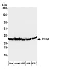 Detection of human PCNA by western blot with HRP-conjugated Goat anti-Mouse IgG2a Cross-Adsorbed Antibody.