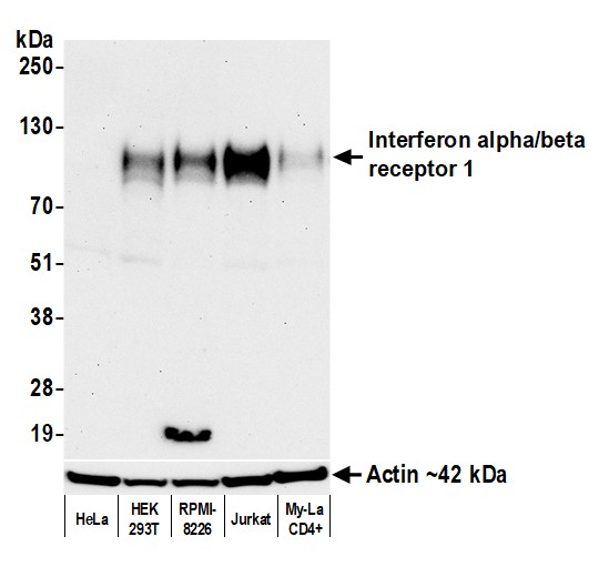 Rabbit anti-Interferon alpha/beta receptor 1 Recombinant Monoclonal Antibody [BLR265L]
