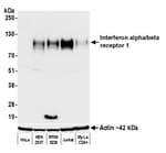 Detection of human Interferon alpha/beta receptor 1 by western blot.