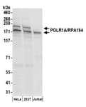 Detection of human POLR1A/RPA194 by western blot.