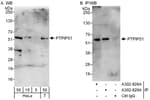 Detection of human PTPIP51 by western blot and immunoprecipitation.