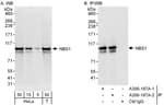 Detection of human NBS1 by western blot and immunoprecipitation.
