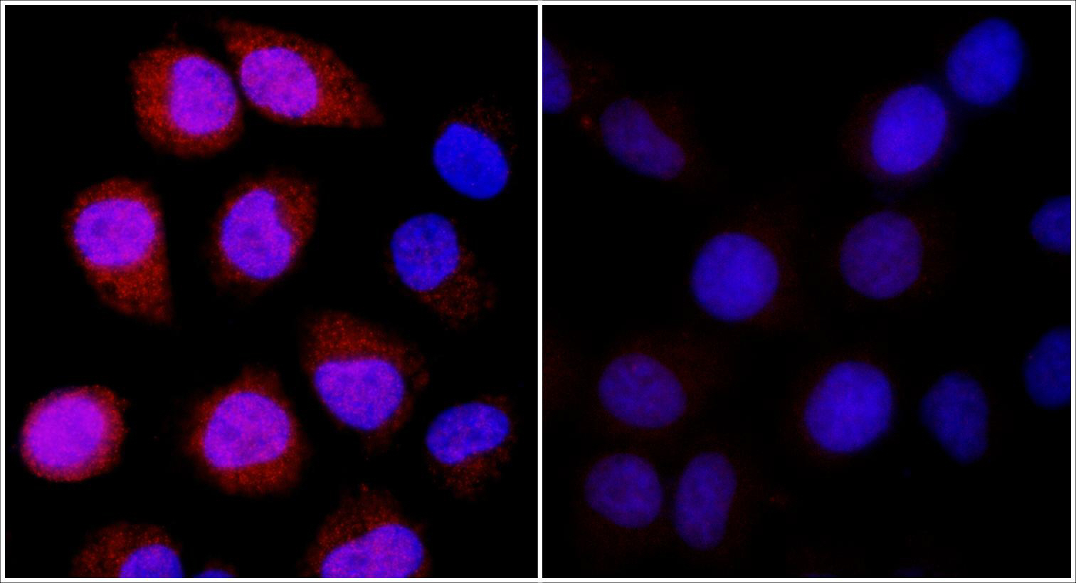 Rabbit anti-REDD1 IHC Antibody