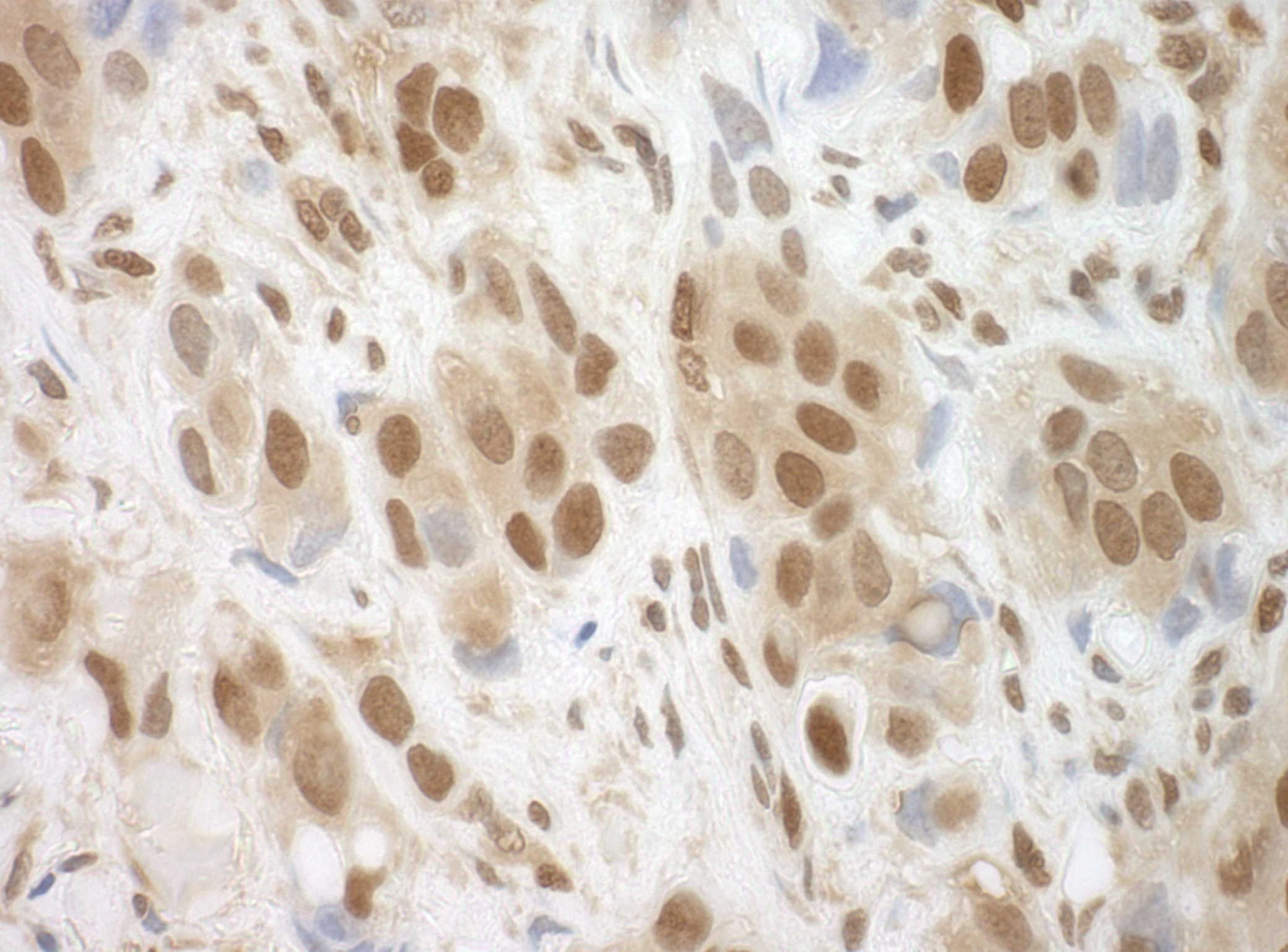 Rabbit anti-BRCC36 IHC Antibody
