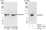 Detection of human and mouse NARG1 by western blot (h&amp;m) and immunoprecipitation (h).