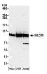 Detection of human MED15 by western blot.