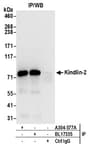 Detection of human Kindlin-2 by western blot of immunoprecipitates.