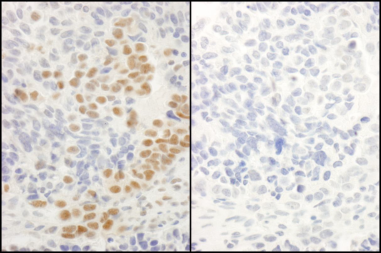 Rabbit anti-Phospho RelA (S536) IHC Antibody