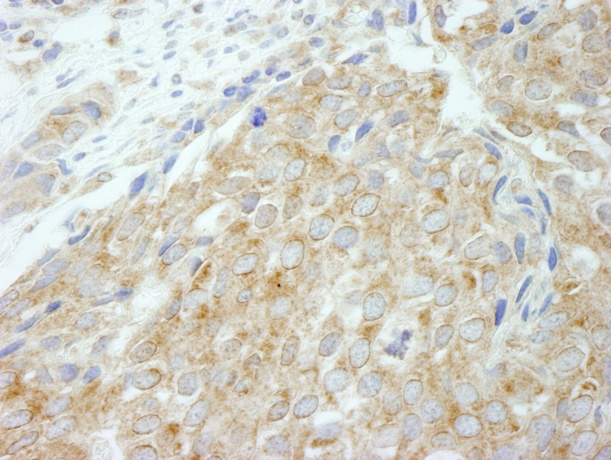 Rabbit anti-Flightless-1 IHC Antibody