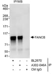 Detection of human FANCB by western blot of immunoprecipitates.