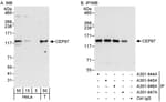 Detection of human CEP97 by western blot and immunoprecipitation.