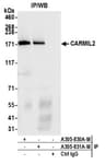 Detection of human CARMIL2 by western blot of immunoprecipitates.