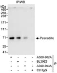 Detection of human Pescadillo by western blot of immunoprecipitates.