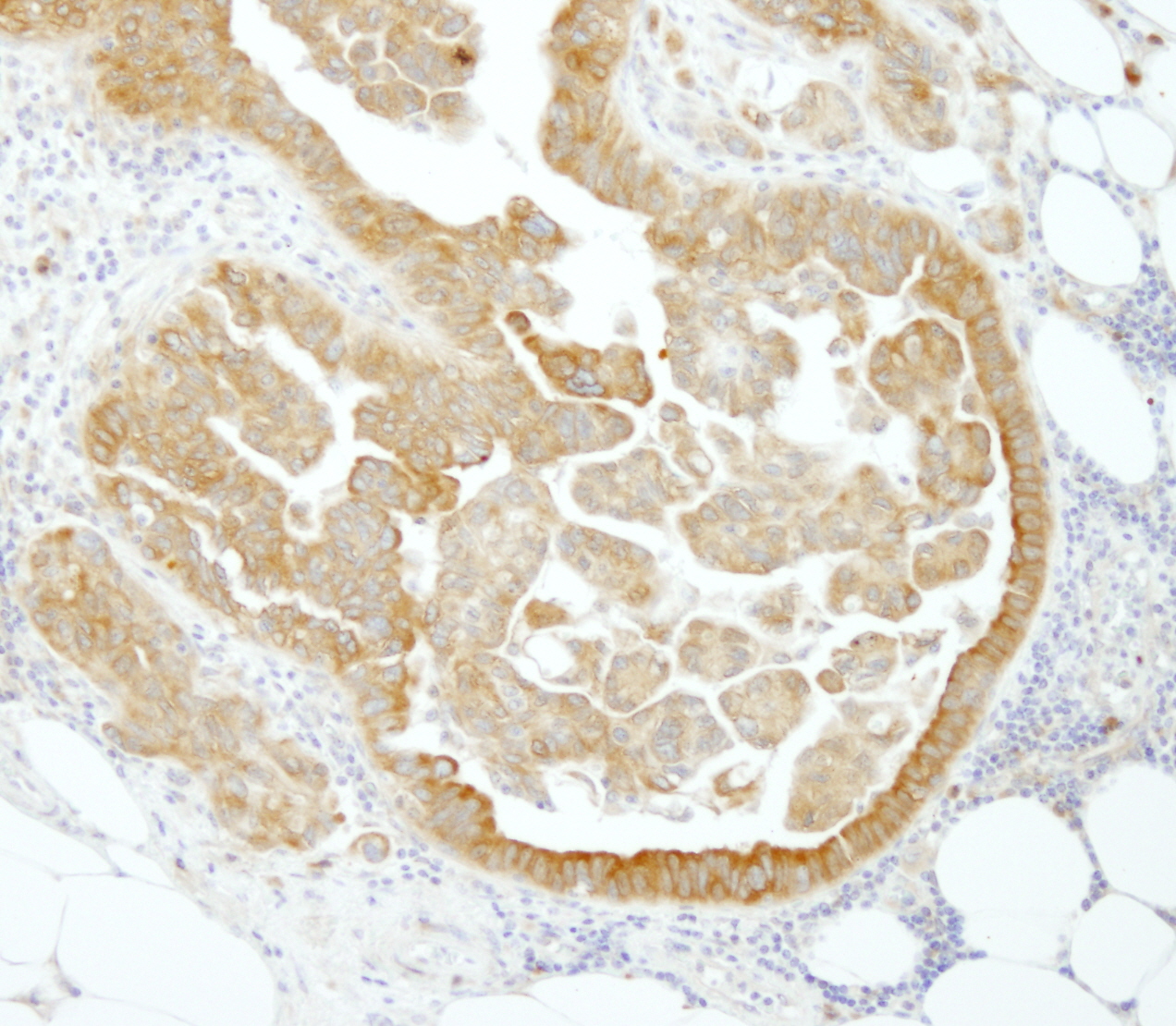Rabbit anti-PABP4 IHC Antibody