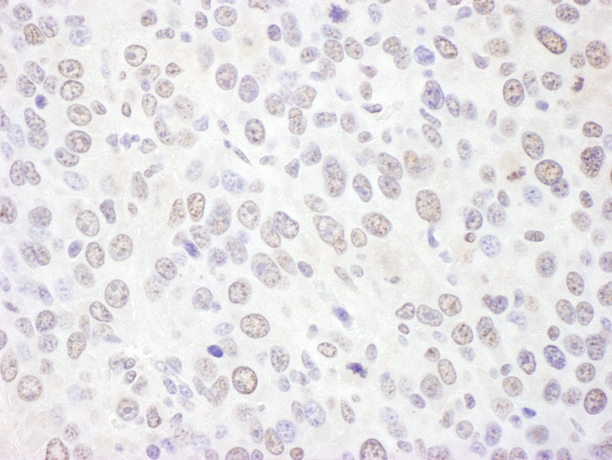 Detection of mouse EXOSC10 by immunohistochemistry.