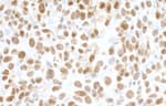 Detection of mouse FUS in FFPE CT26 colon carcinoma by IHC.