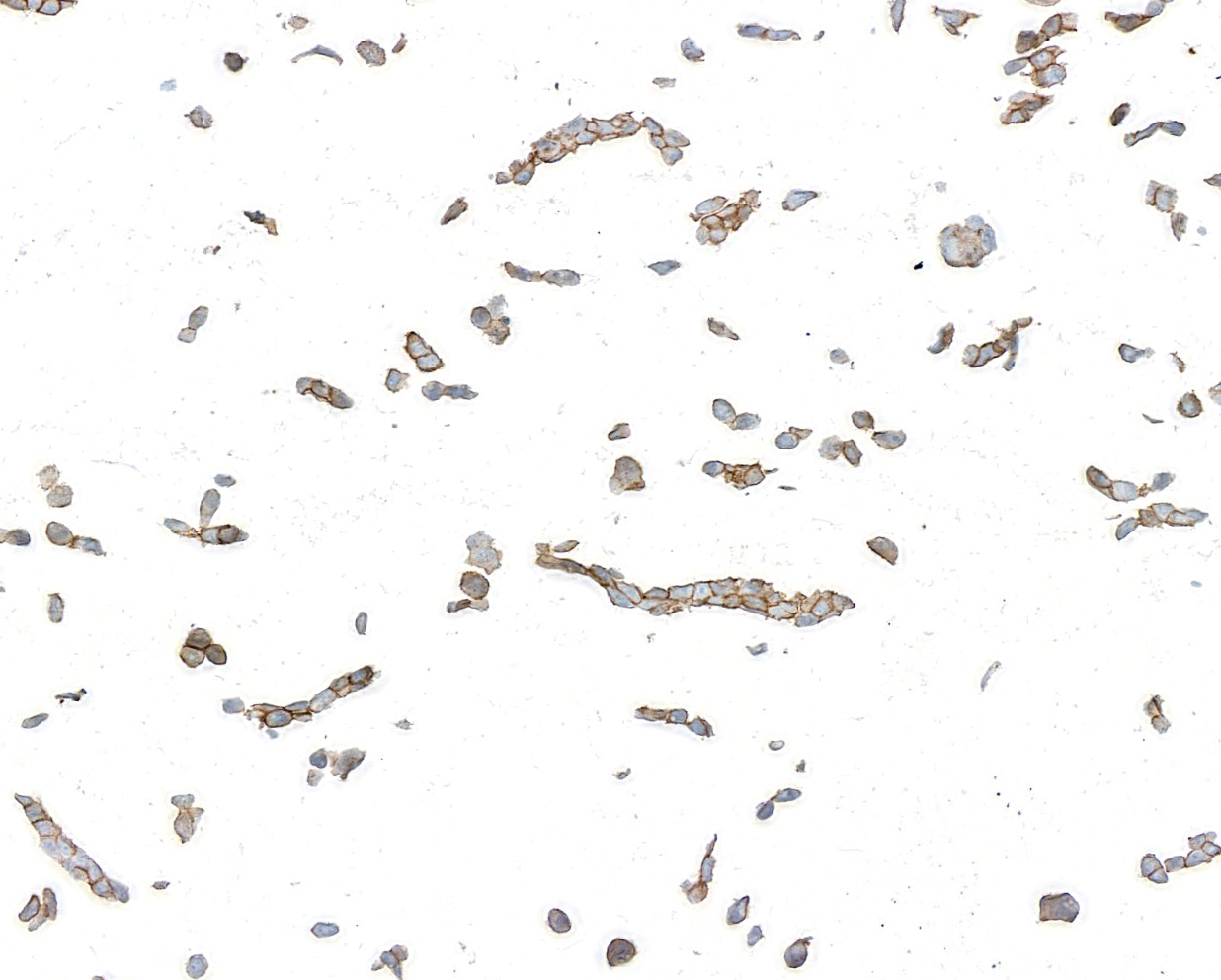 Detection of human Desmoglein 3 by immunocytochemistry.