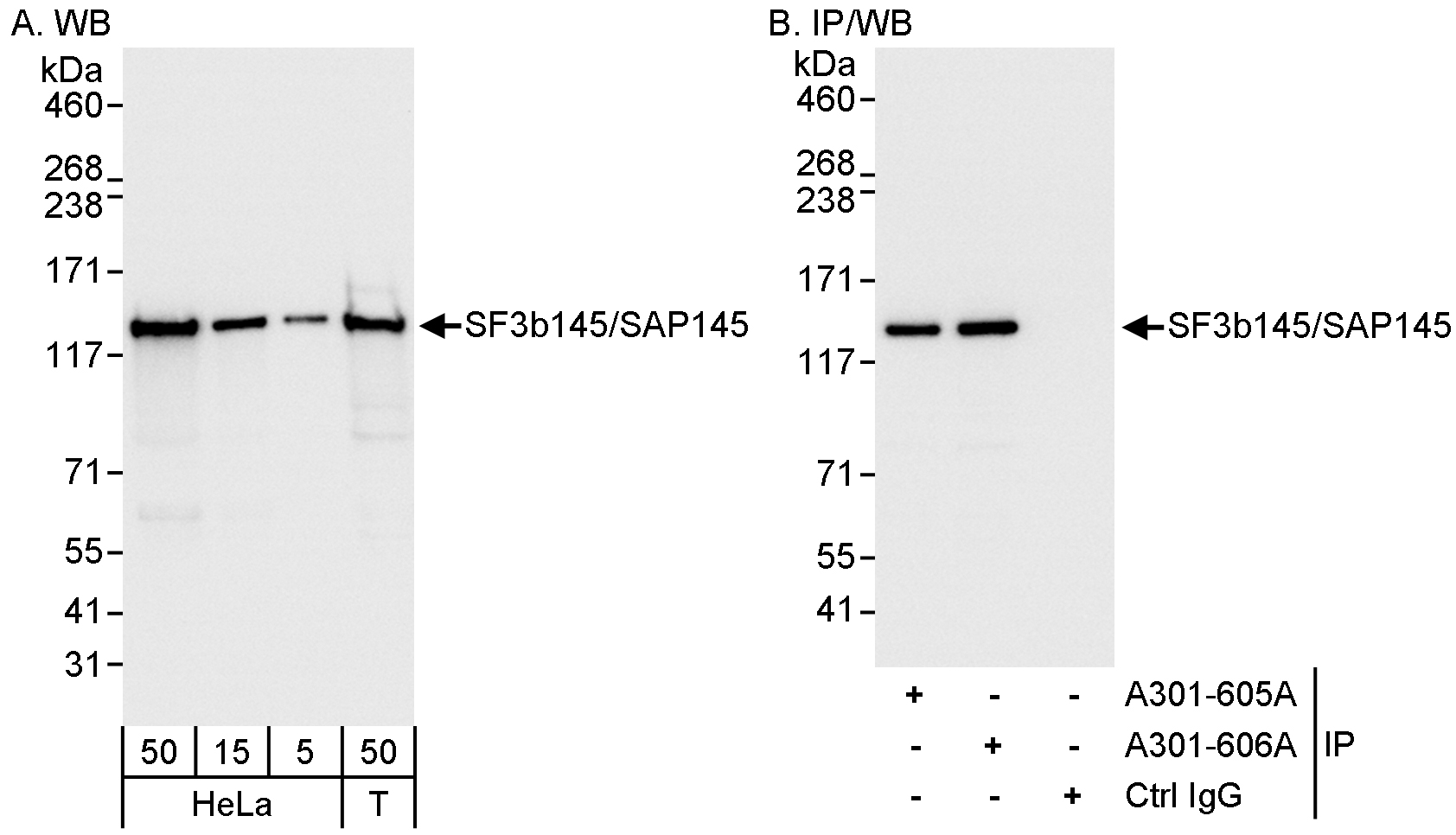 Detection of human SF3b145/SAP145 by western blot and immunoprecipitation.