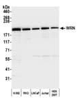 Detection of human WRN by western blot.
