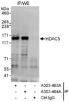 Detection of human HDAC5 by western blot of immunoprecipitates.
