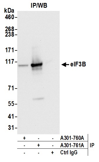 Detection of human eIF3B by western blot of immunoprecipitates.