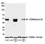Detection of human CCNA2/Cyclin A2 by western blot.