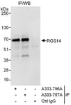 Detection of human RGS14 by western blot of immunoprecipitates.