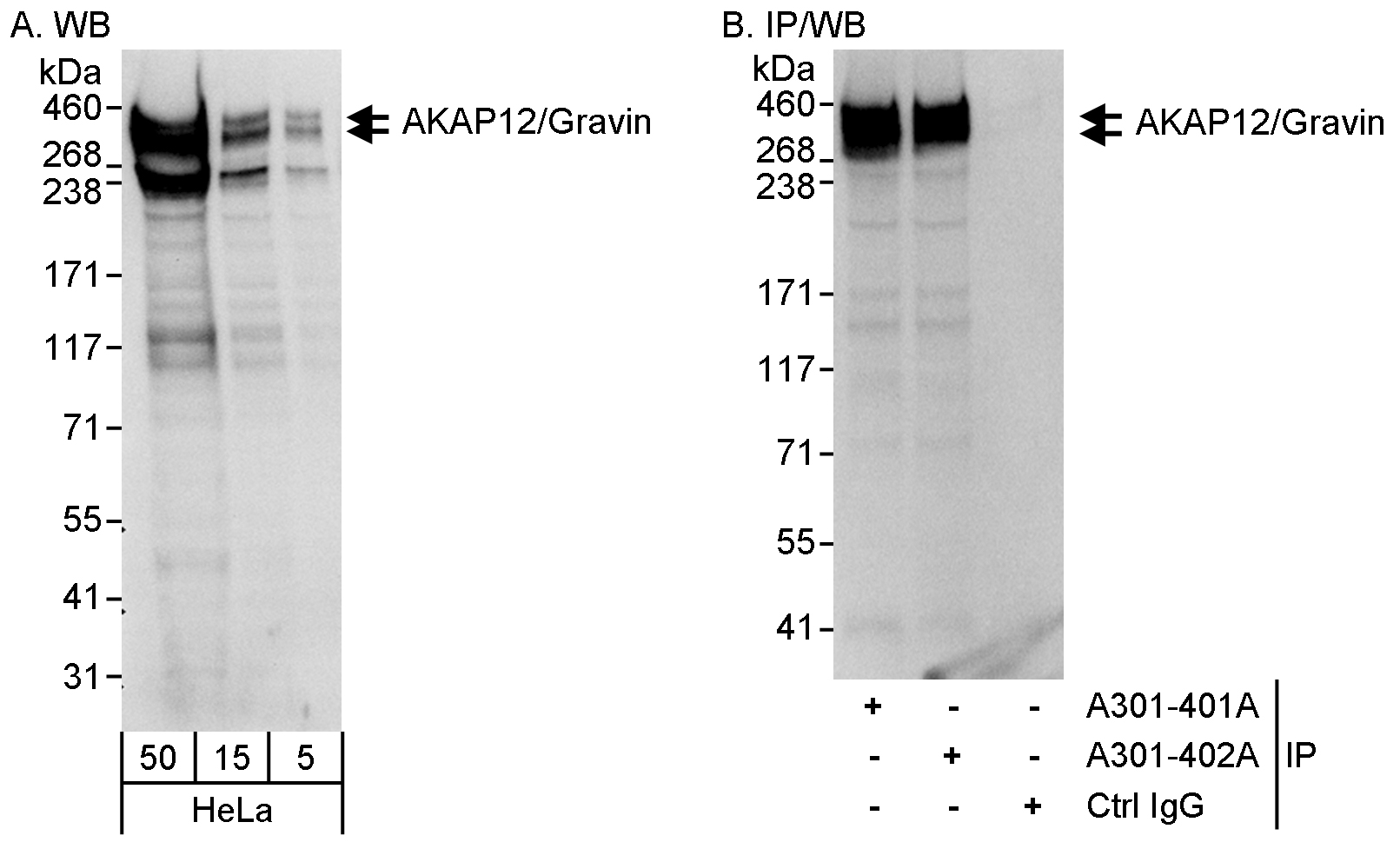 Detection of human AKAP12/Gravin by western blot and immunoprecipitation.