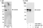 Detection of human CCDC6 by western blot and immunoprecipitation.