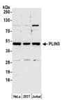 Detection of human PLIN3 by western blot.