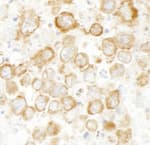 Detection of mouse CKAP4 by immunohistochemistry.