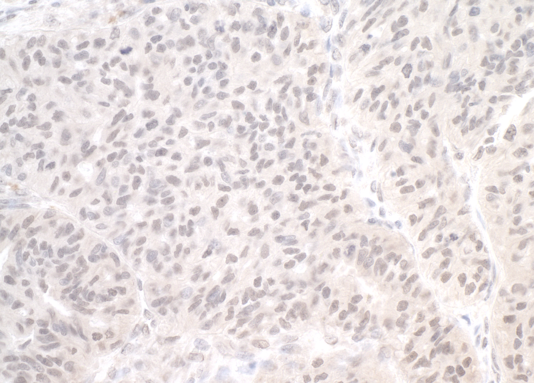 Rabbit anti-PIMT IHC Antibody