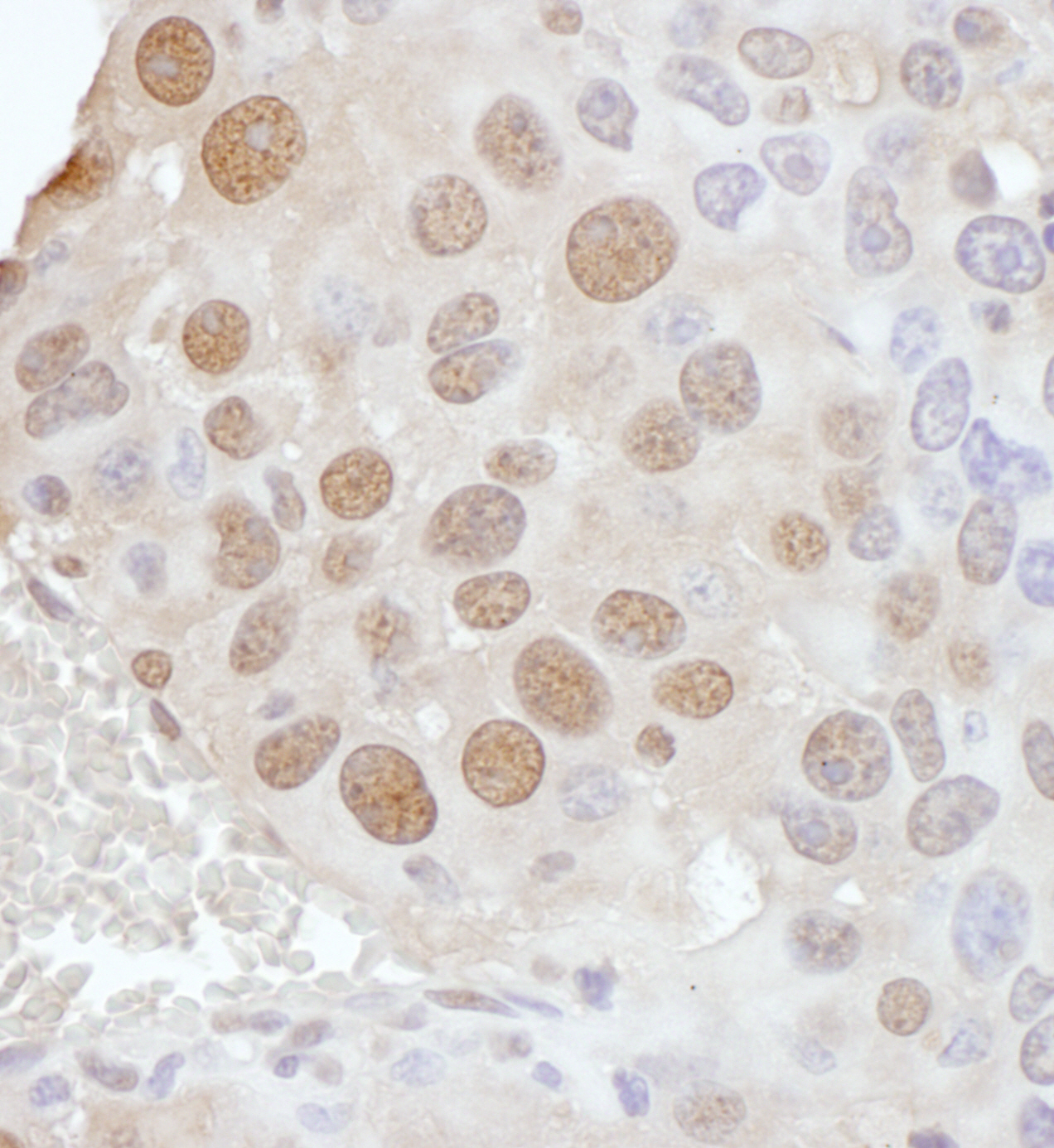 Detection of mouse PCYT1A by immunohistochemistry.