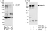 Detection of human ANKHD1 by western blot and immunoprecipitation.