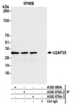Detection of human U2AF35 by western blot of immunoprecipitates.