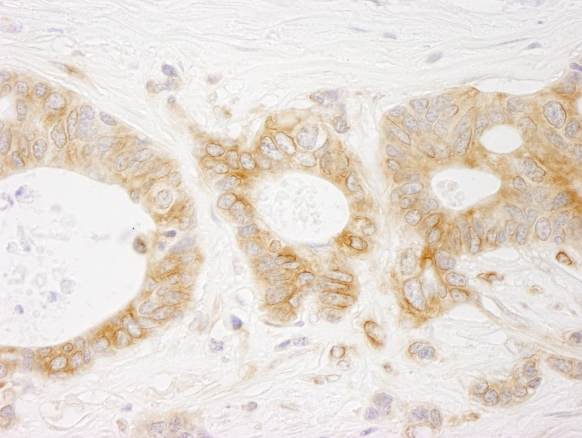 Rabbit anti-EML4 IHC Antibody