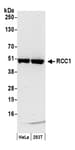 Detection of human RCC1 by western blot.