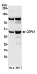 Detection of human CEP41 by western blot.