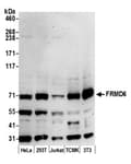 Detection of human and mouse FRMD6 by western blot.